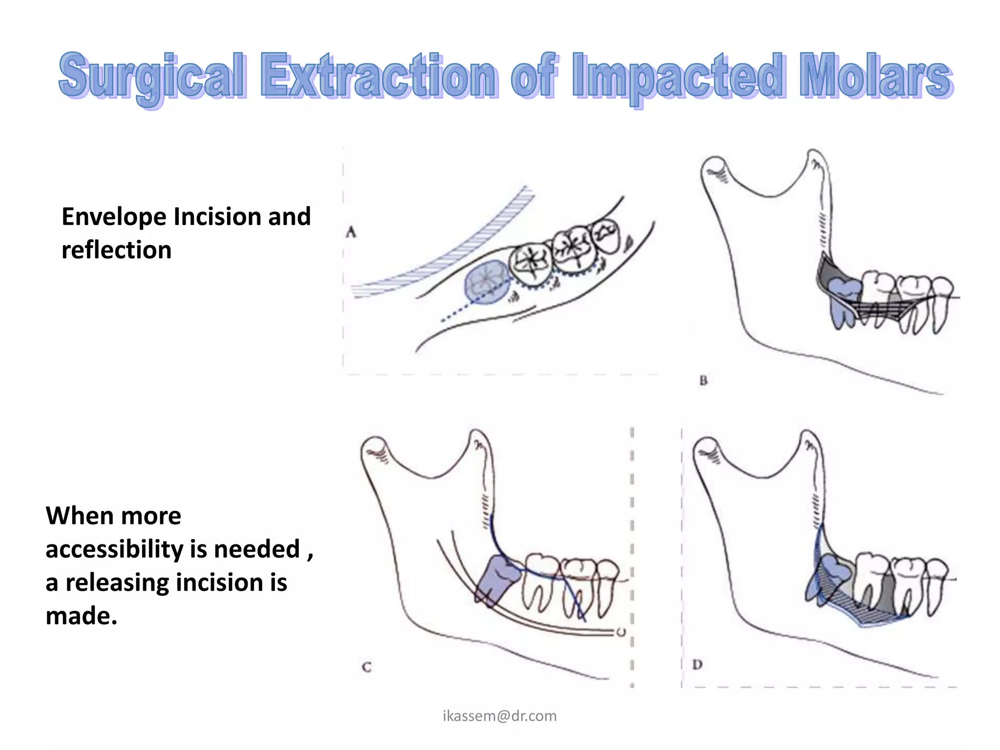 Envelope Incision and
 reflection




When more
accessibility is needed ,
a releasing incision is
made.


                            ikassem@dr.com
 