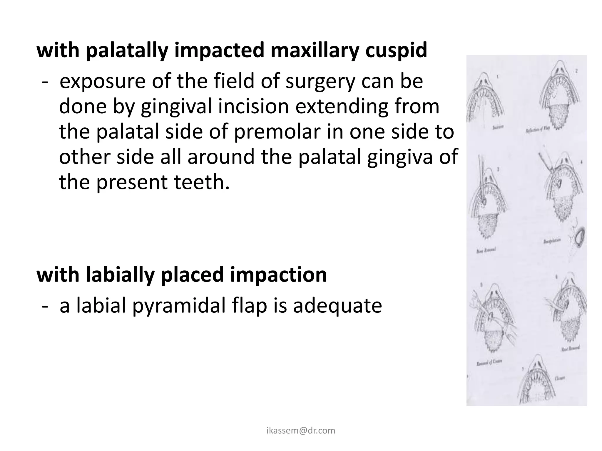 with palatally impacted maxillary cuspid
- exposure of the field of surgery can be
  done by gingival incision extending from
  the palatal side of premolar in one side to
  other side all around the palatal gingiva of
  the present teeth.


with labially placed impaction
- a labial pyramidal flap is adequate




                         ikassem@dr.com
 
