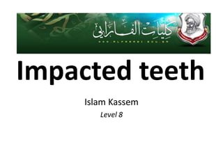 Impacted teeth
     Islam Kassem
        Level 8
 