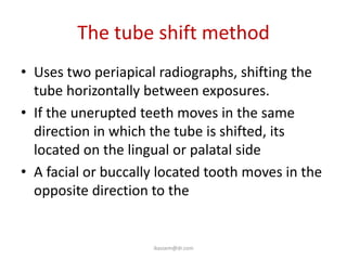The tube shift method
• Uses two periapical radiographs, shifting the
  tube horizontally between exposures.
• If the unerupted teeth moves in the same
  direction in which the tube is shifted, its
  located on the lingual or palatal side
• A facial or buccally located tooth moves in the
  opposite direction to the tube shift.


                     ikassem@dr.com
 