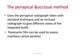 The periapical &occlusal method
• Uses the periapical radiograph taken with
  standard technique and an occlusal
  radiograph to give different views of the
  impacted tooth.
• Panoramic film can be used to assess
  maxillary canine position



                    ikassem@dr.com
 