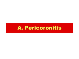A. Pericoronitis
 