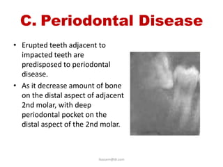 C. Periodontal Disease
• Erupted teeth adjacent to
  impacted teeth are
  predisposed to periodontal
  disease.
• As it decrease amount of bone
  on the distal aspect of adjacent
  2nd molar, with deep
  periodontal pocket on the
  distal aspect of the 2nd molar.



                          ikassem@dr.com
 