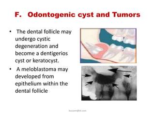 F. Odontogenic cyst and Tumors

• The dental follicle may
  undergo cystic
  degeneration and
  become a dentigerios
  cyst or keratocyst.
• A meloblastoma may
  developed from
  epithelium within the
  dental follicle


                       ikassem@dr.com
 