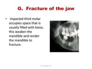 G. Fracture of the jaw

• impacted third molar
  occupies space that is
  usually filled with bone,
  this weaken the
  mandible and render
  the mandible to
  fracture.




                         ikassem@dr.com
 
