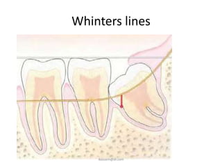Whinters lines




    ikassem@dr.com
 
