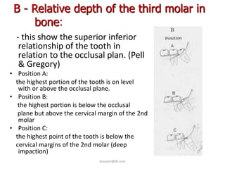 B - Relative depth of the third molar in
     bone:
  - this show the superior inferior
   relationship of the tooth in
   relation to the occlusal plan. (Pell
   & Gregory)
• Position A:
  the highest portion of the tooth is on level
   with or above the occlusal plane.
• Position B:
   the highest portion is below the occlusal
   plane but above the cervical margin of the 2nd
   molar
• Position C:
  the highest point of the tooth is below the
  cervical margins of the 2nd molar (deep
   impaction)
                               ikassem@dr.com
 