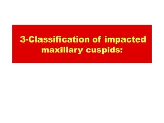 3-Classification of impacted
     maxillary cuspids:
 