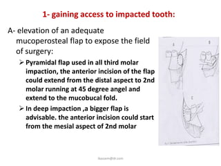 1- gaining access to impacted tooth:
A- elevation of an adequate
  mucoperosteal flap to expose the field
  of surgery:
    Pyramidal flap used in all third molar
     impaction, the anterior incision of the flap
     could extend from the distal aspect to 2nd
     molar running at 45 degree angel and
     extend to the mucobucal fold.
    In deep impaction ,a bigger flap is
     advisable. the anterior incision could start
     from the mesial aspect of 2nd molar



                             ikassem@dr.com
 