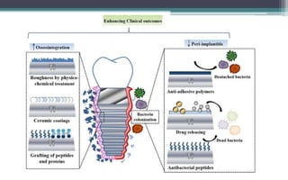 Impact of dental implant surface modifications on Osseo-integration | PPTX