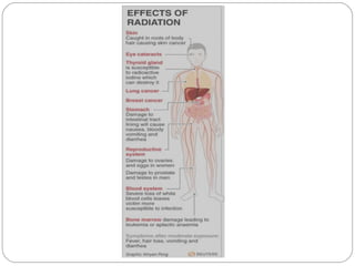 Impact of radiation pollution on human health siri | PPT