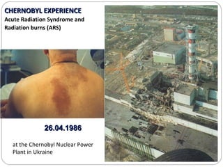 Impact of radiation pollution on human health siri | PPT