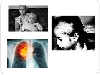 Impact of radiation pollution on human health siri | PPT