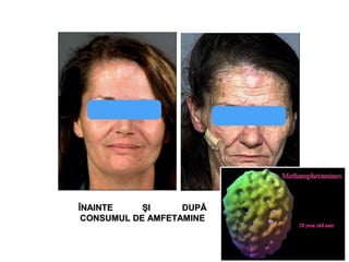 ÎNAINTE ŞI DUPĂÎNAINTE ŞI DUPĂ
CONSUMUL DE AMFETAMINECONSUMUL DE AMFETAMINE
 