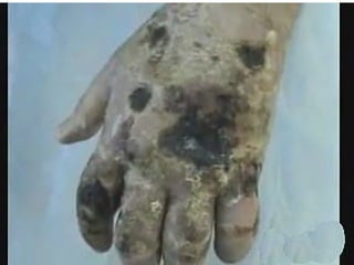 Eudochia PACIU. Impactul consumului de droguri.