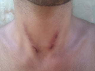 Eudochia PACIU. Impactul consumului de droguri.