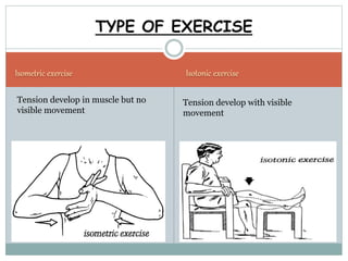 Isometric exercise Isotonic exercise
TYPE OF EXERCISE
Tension develop in muscle but no
visible movement
Tension develop with visible
movement
 