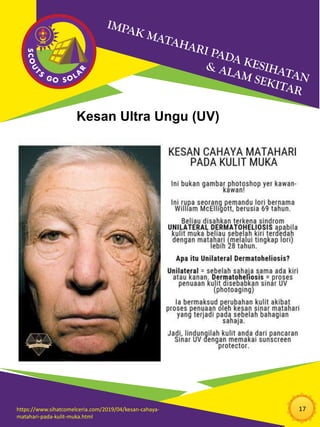 17
Kesan Ultra Ungu (UV)
https://www.sihatcomelceria.com/2019/04/kesan-cahaya-
matahari-pada-kulit-muka.html
 
