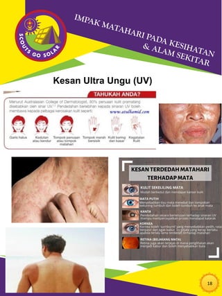 18
Kesan Ultra Ungu (UV)
 