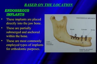 BASED ON THE LOCATION
ENDOSSEOUS
IMPLANTS
• These implants are placed
directly into the jaw bone.
• These are partially
su...