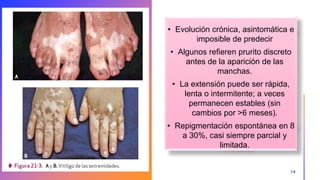 • Evolución crónica, asintomática e
imposible de predecir
• Algunos refieren prurito discreto
antes de la aparición de las
manchas.
• La extensión puede ser rápida,
lenta o intermitente; a veces
permanecen estables (sin
cambios por >6 meses).
• Repigmentación espontánea en 8
a 30%, casi siempre parcial y
limitada.
14
 