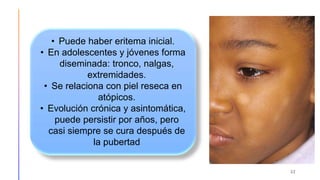 22
• Puede haber eritema inicial.
• En adolescentes y jóvenes forma
diseminada: tronco, nalgas,
extremidades.
• Se relaciona con piel reseca en
atópicos.
• Evolución crónica y asintomática,
puede persistir por años, pero
casi siempre se cura después de
la pubertad
 