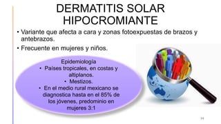 DERMATITIS SOLAR
HIPOCROMIANTE
• Variante que afecta a cara y zonas fotoexpuestas de brazos y
antebrazos.
• Frecuente en mujeres y niños.
24
Epidemiología
• Países tropicales, en costas y
altiplanos.
• Mestizos.
• En el medio rural mexicano se
diagnostica hasta en el 85% de
los jóvenes, predominio en
mujeres 3:1
 