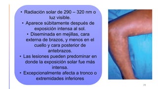 25
• Radiación solar de 290 – 320 nm o
luz visible.
• Aparece súbitamente después de
exposición intensa al sol.
• Diseminada en mejillas, cara
externa de brazos, y menos en el
cuello y cara posterior de
antebrazos.
• Las lesiones pueden predominar en
donde la exposición solar fue más
intensa.
• Excepcionalmente afecta a tronco o
extremidades inferiores
 