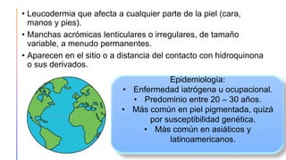 • Leucodermia que afecta a cualquier parte de la piel (cara,
manos y pies).
• Manchas acrómicas lenticulares o irregulares, de tamaño
variable, a menudo permanentes.
• Aparecen en el sitio o a distancia del contacto con hidroquinona
o sus derivados.
Epidemiología:
• Enfermedad iatrógena u ocupacional.
• Predominio entre 20 – 30 años.
• Más común en piel pigmentada, quizá
por susceptibilidad genética.
• Más común en asiáticos y
latinoamericanos.
 