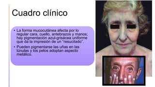 Cuadro clínico
• La forma mucocutánea afecta por lo
regular cara, cuello, antebrazos y manos;
hay pigmentación azul-grisácea uniforme
que da la impresión de un “resucitado”.
• Pueden pigmentarse las uñas en las
lúnulas y los pelos adoptan aspecto
metálico.
49
 