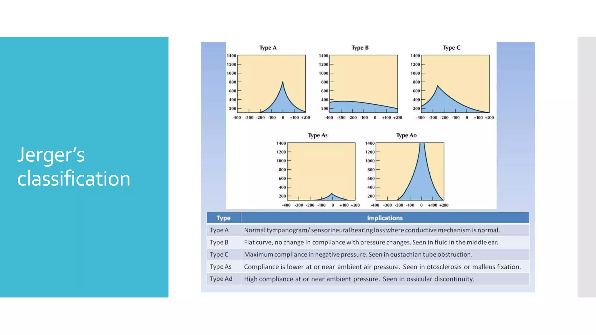 Jerger’s
classification