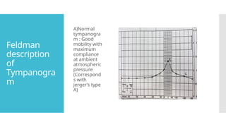 Feldman
description
of
Tympanogra
m
A)Normal
tympanogra
m : Good
mobility with
maximum
compliance
at ambient
atmospheric
pressure
(Correspond
s with
jerger’s type
A)
 
