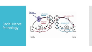 Facial Nerve
Pathology
 