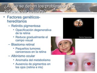 ¿A qué se deben los problemas y las deficiencias visuales? Factores genéticos-hereditarios Retinitis pigmentosa Opacificación degenerativa de la retina Reduce gradualmente el campo visual Blastoma retinal Pequeños tumores cancerosos en la retina Albinismo ocular Anomalía del metabolismo Ausencia de pigmentos en los ojos (retina e iris) 