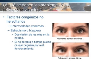 ¿A qué se deben los problemas y las deficiencias visuales? Factores congénitos no hereditarios Enfermedades venéreas Estrabismo o bizquera Desviación de los ojos en la mirada.  Si no se trata a tiempo puede causar ceguera por mal funcionamiento.  