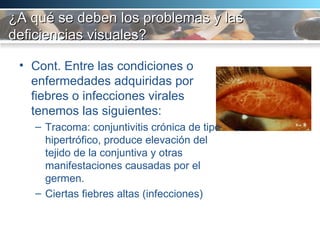 ¿A qué se deben los problemas y las deficiencias visuales? Cont. Entre las condiciones o enfermedades adquiridas por fiebres o infecciones virales tenemos las siguientes:  Tracoma: conjuntivitis crónica de tipo hipertrófico, produce elevación del tejido de la conjuntiva y otras manifestaciones causadas por el germen.  Ciertas fiebres altas (infecciones) 