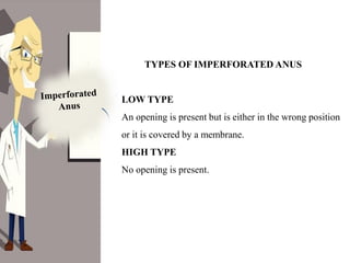 impereforate anus presentation including defination and types | PDF