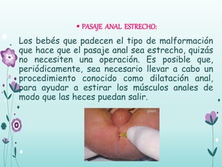  PASAJE ANAL ESTRECHO:
Los bebés que padecen el tipo de malformación
que hace que el pasaje anal sea estrecho, quizás
no necesiten una operación. Es posible que,
periódicamente, sea necesario llevar a cabo un
procedimiento conocido como dilatación anal,
para ayudar a estirar los músculos anales de
modo que las heces puedan salir.
 