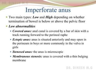 Imperforate anus
 Two main types: Low and High depending on whether
termination of bowel is below or above the pelvic floor
 Low abnormalities
 Covered anus: anal canal is covered by a bar of skin with a
track running forward to the perineal raphe
 Ectopic anus: anus is situated anteriorly and may open in
the perineum in boys or more commonly in the vulva in
girls
 Stenosed anus: the anus is microscopic
 Membranous stenosis: anus is covered with a thin bulging
membrane
 