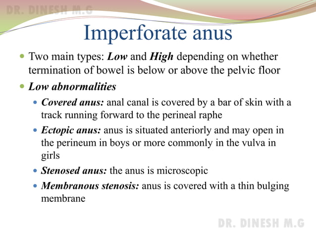 Imperforate Anus | PDF | Digestive Disorders | Diseases and Conditions