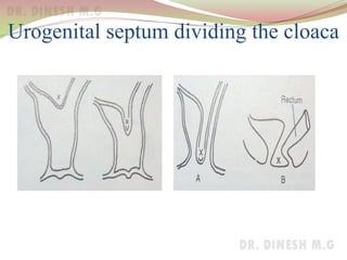 Urogenital septum dividing the cloaca
 
