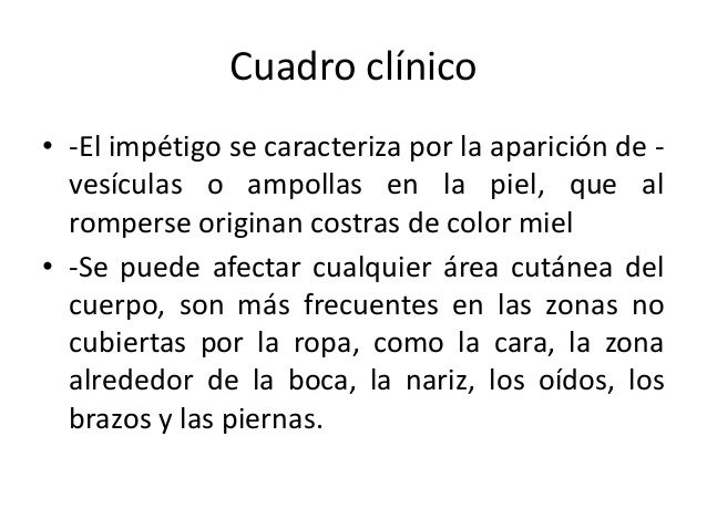 El modelo ruso con las pecas