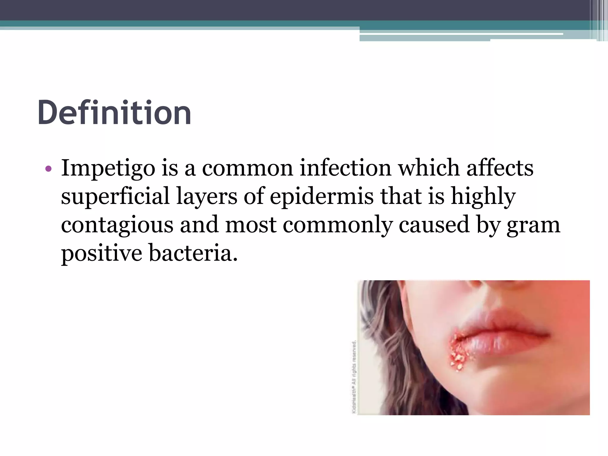Impetigo | PPTX
