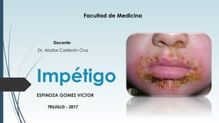 Impétigo
ESPINOZA GOMEZ VICTOR
Facultad de Medicina
TRUJILLO - 2017
Dr. Abdias Calderón Cruz
Docente
 
