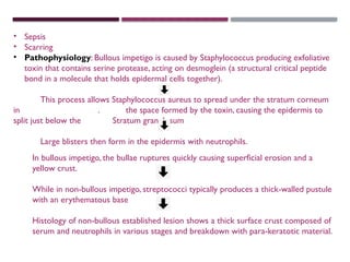 Bullous Process Impetigo Case presentation Psoriasis is a chronic skin disease that ...