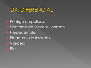  Pénfigo ampolloso. 
 Síndrome de Stevens-Johnson. 
 Herpes simple. 
 Picaduras de insectos. 
 Varicela. 
 Etc. 
 