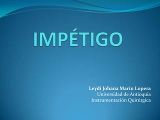 Leydi Johana Marín Lopera
    Universidad de Antioquia
 Instrumentación Quirúrgica
 