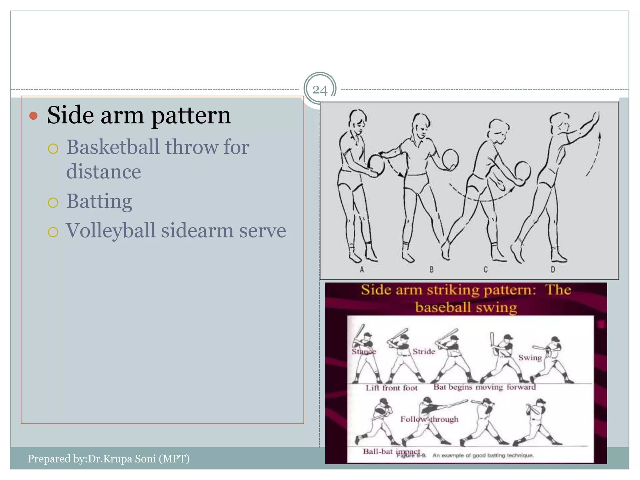 Prepared by:Dr.Krupa Soni (MPT)
24
 Side arm pattern
 Basketball throw for
distance
 Batting
 Volleyball sidearm serve
 