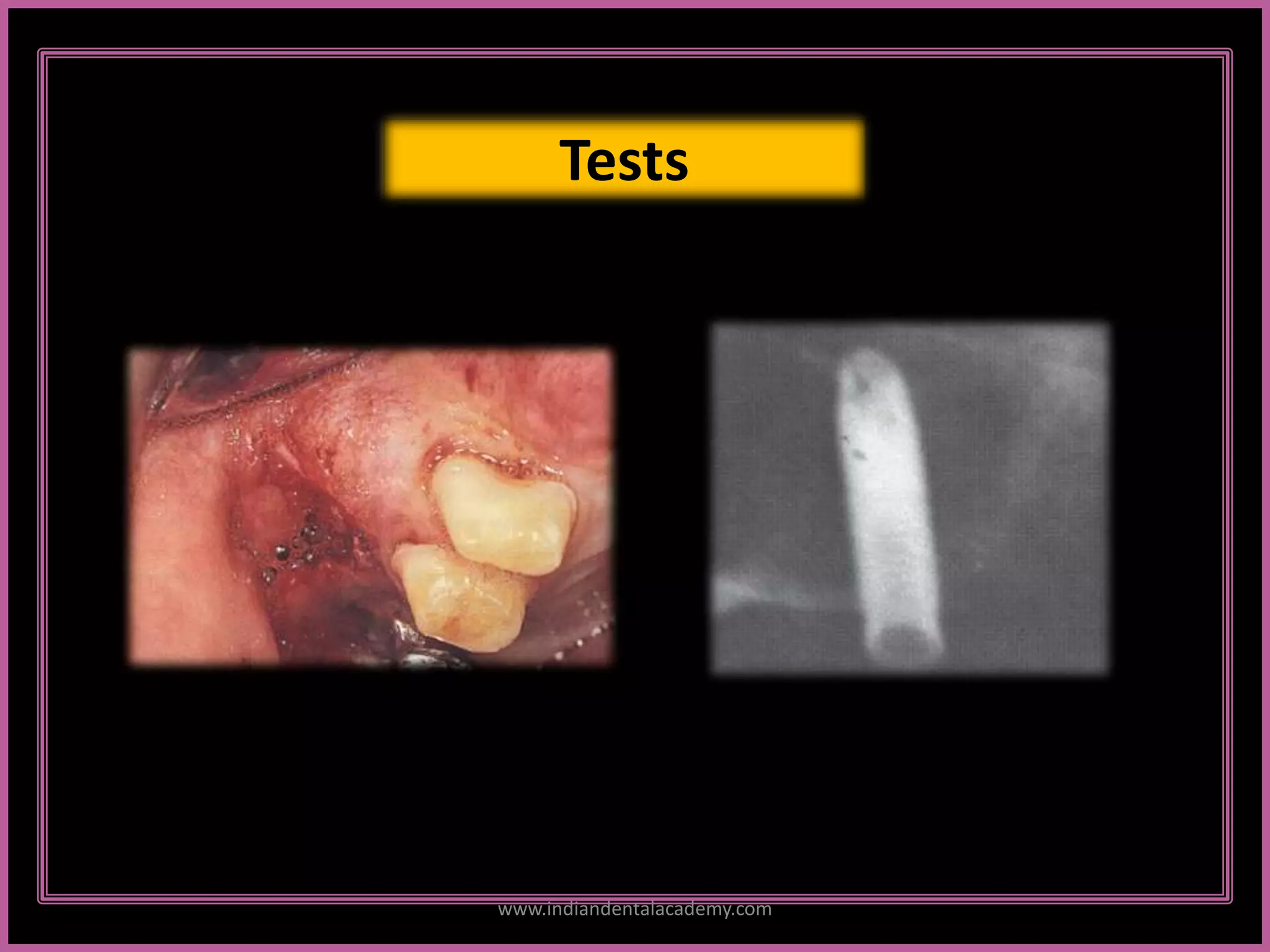 Tests
www.indiandentalacademy.com
 
