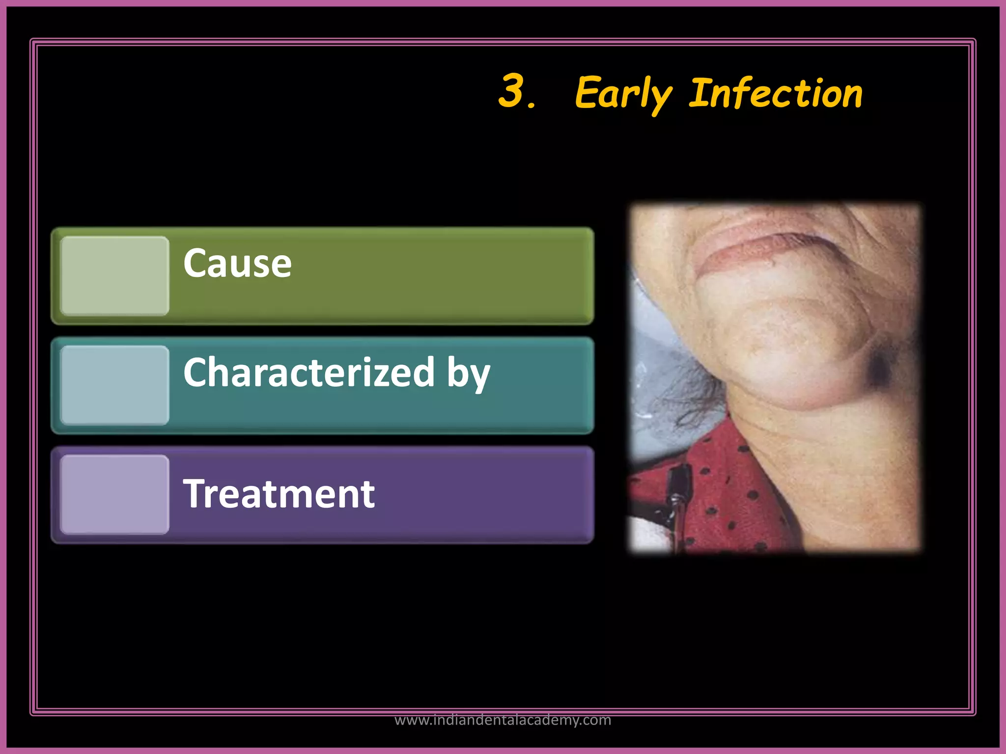 3. Early Infection
Cause
Characterized by
Treatment
www.indiandentalacademy.com
 